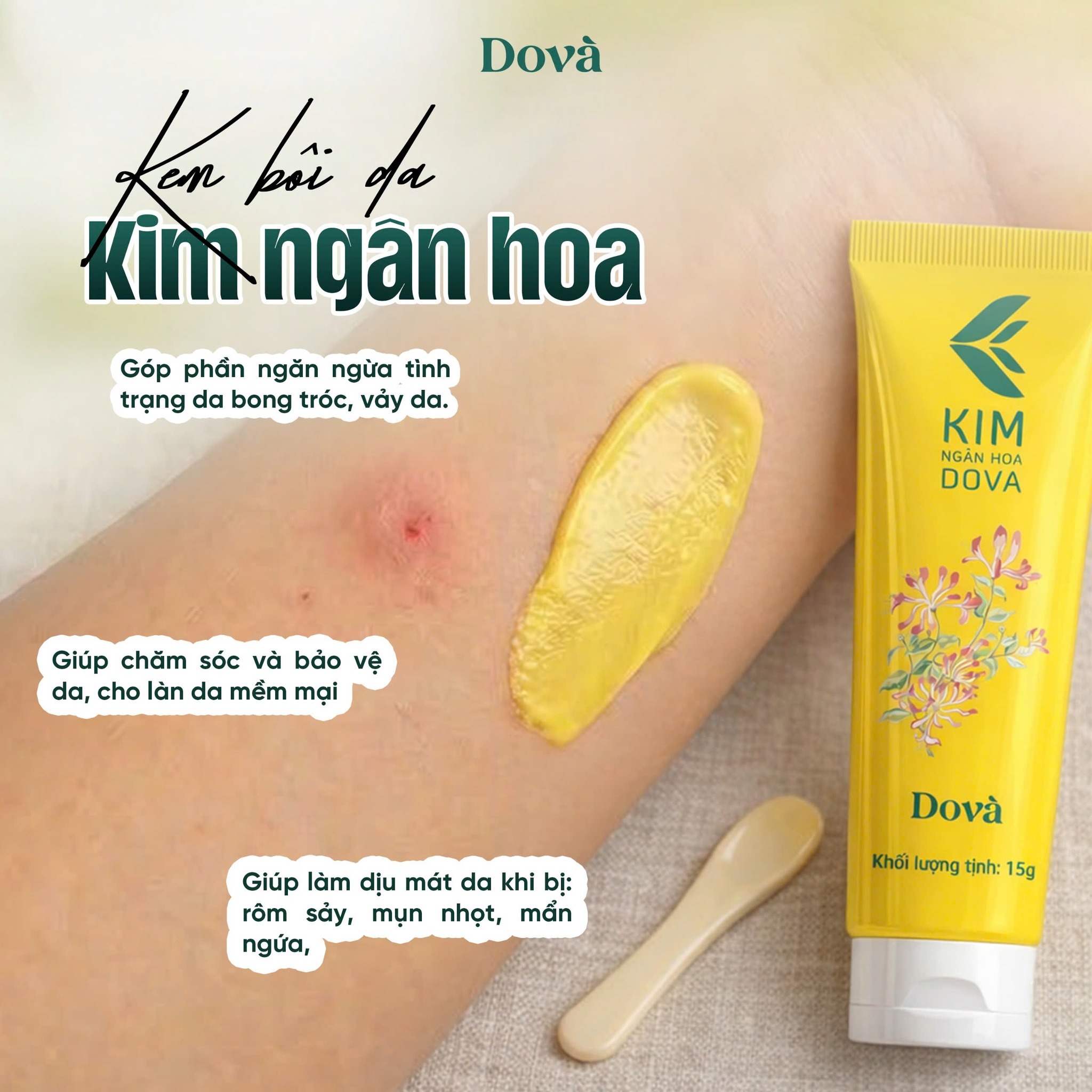 Mẹ lo lắng vì con hay bị muỗi đốt, nổi mụn, viêm da mẩn ngứa
